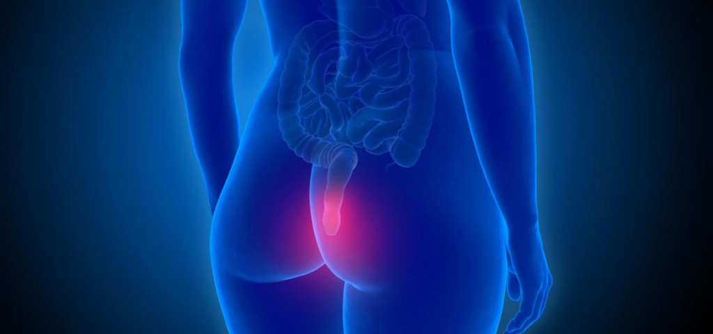 Появление тромбоза геморроидальных узлов Появление тромбоза геморроидальных узлов