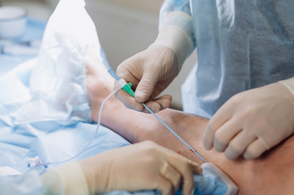 Доктора проводят эндовазальную лазерную коагуляцию вен нижних конечностей